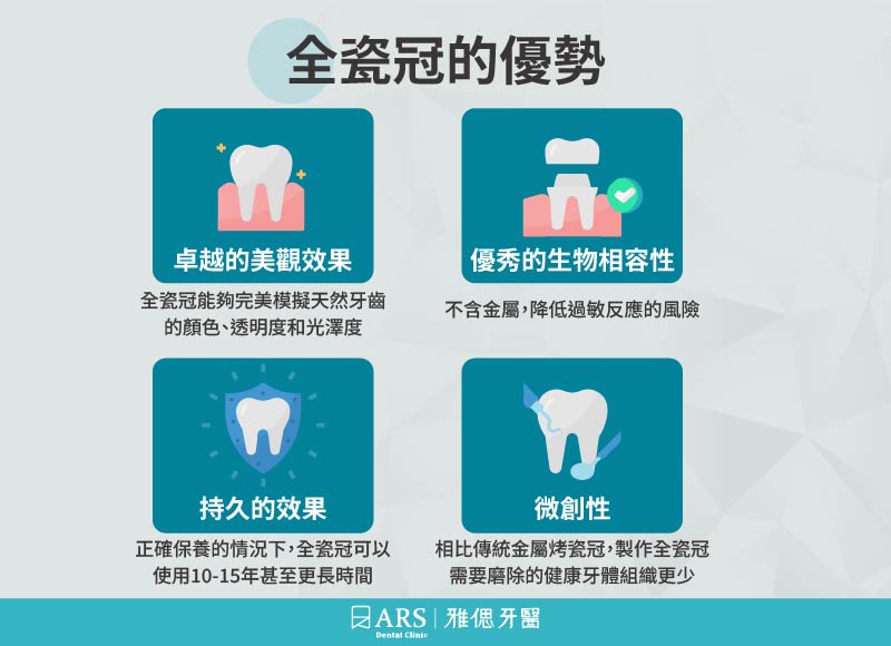 全瓷冠是什麼？價格、壽命與治療流程解說_1