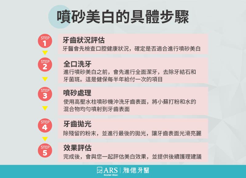 噴砂美白牙齒：效果、流程及價格詳解_1